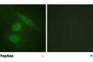 Immunofluorescence analysis of HeLa cells, using IRF3 polyclonal antibody . (IRF3 抗体)
