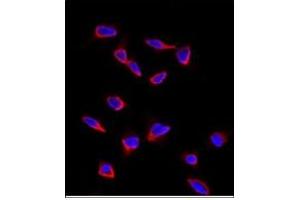 Image no. 3 for anti-SRY (Sex Determining Region Y)-Box 9 (SOX9) (N-Term) antibody (ABIN356879)