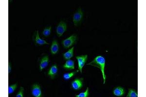 Immunofluorescent analysis of A549 cells using ABIN7164574 at dilution of 1:100 and Alexa Fluor 488-congugated AffiniPure Goat Anti-Rabbit IgG(H+L) (ZDHHC2 抗体  (AA 75-130))