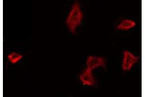ABIN6266644 staining HeLa by IF/ICC. (PAR1 抗体  (N-Term))