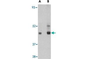 Western blot analysis of PAFAH1B1 in HeLa cell lysate with PAFAH1B1 polyclonal antibody  at (A) 0. (PAFAH1B1 抗体  (C-Term))