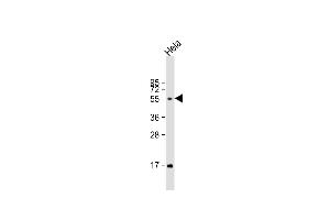 Anti-FUT6 Antibody (Center) at 1:1000 dilution + Hela whole cell lysate Lysates/proteins at 20 μg per lane. (FUT6 抗体  (AA 102-130))