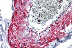 Human Vessel: Formalin-Fixed, Paraffin-Embedded (FFPE) (MYOC 抗体  (AA 36-135))