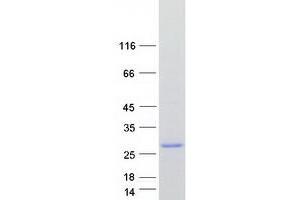 Western Blotting (WB) image for RAP1A, Member of RAS Oncogene Family (RAP1A) (Transcript Variant 2) protein (Myc-DYKDDDDK Tag) (ABIN2730472)