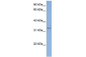 WB Suggested Anti-DAZL Antibody Titration:  0. (DAZL 抗体  (C-Term))
