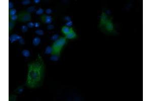 Image no. 3 for anti-Phosphoinositide-3-Kinase, Regulatory Subunit 5 (PIK3R5) antibody (ABIN1500214) (PIK3R5 抗体)