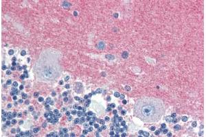 Human Brain, Cerebellum (formalin-fixed, paraffin-embedded) stained with RAB3A antibody ABIN462094 at 10 ug/ml followed by biotinylated goat anti-rabbit IgG secondary antibody ABIN481713, alkaline phosphatase-streptavidin and chromogen. (RAB3A 抗体  (AA 202-217))