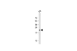 Western Blotting (WB) image for anti-Von Hippel-Lindau Tumor Suppressor, E3 Ubiquitin Protein Ligase (VHL) (AA 43-71), (N-Term) antibody (ABIN390462)