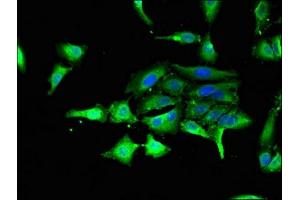 Immunofluorescent analysis of Hela cells using ABIN7154214 at dilution of 1:100 and Alexa Fluor 488-congugated AffiniPure Goat Anti-Rabbit IgG(H+L) (GSK3 alpha 抗体  (AA 36-118))