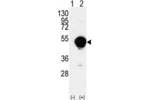 Western Blotting (WB) image for anti-Cytochrome P450, Family 20, Subfamily A, Polypeptide 1 (CYP20A1) antibody (ABIN3003220) (CYP20A1 抗体)