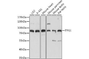Western blot analysis of extracts of various cell lines, using ITFG1 antibody (ABIN7267919) at 1:1000 dilution. (ITFG1 抗体  (AA 313-612))