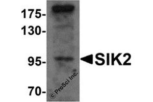 Western Blotting (WB) image for anti-Salt-Inducible Kinase 2 (SIK2) (Middle Region) antibody (ABIN1031093) (SIK2 抗体  (Middle Region))