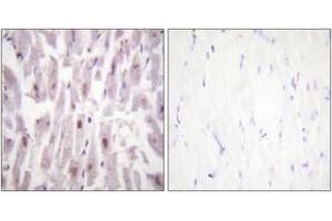 Immunohistochemistry analysis of paraffin-embedded human heart, using PPAR-BP (Phospho-Thr1457) Antibody. (PPAR-BP (AA 1423-1472), (pThr1457) 抗体)
