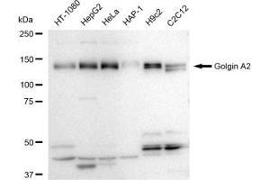 Western blotting analysis using Golgin A2 antibody (ABIN7798797). (Recombinant Golgin A2 (GOLGA2) 抗体)