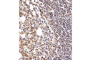 Immunohistochemistry (Paraffin-embedded Sections) (IHC (p)) image for anti-Major Histocompatibility Complex, Class I, B (HLA-B) (AA 75-107), (N-Term) antibody (ABIN1944779)