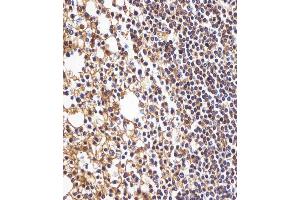 (ABIN1944779 and ABIN2838521) staining HLA-B in human tonsil tissue sections by Immunohistochemistry (IHC-P - paraformaldehyde-fixed, paraffin-embedded sections). (HLA-B 抗体  (N-Term))