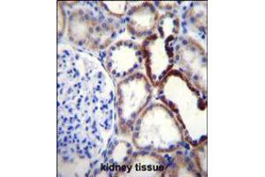 NKD2 Antibody immunohistochemistry analysis in formalin fixed and paraffin embedded human kidney tissue followed by peroxidase conjugation of the secondary antibody and DAB staining. (NKD2 抗体  (C-Term))