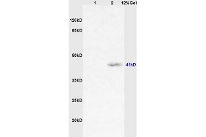 Lane 1: rat lung lysates Lane 2: human colon carcinoma lysates probed with Anti CD64/IGFR1/FCGR1A Polyclonal Antibody, Unconjugated (ABIN747413) at 1:200 in 4 °C. (FCGR1A 抗体  (AA 101-200))