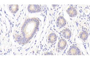 Detection of MMP13 in Porcine Uterus Tissue using Polyclonal Antibody to Matrix Metalloproteinase 13 (MMP13) (MMP13 抗体  (AA 123-270))