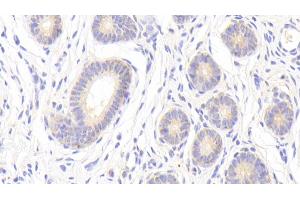 Detection of MMP13 in Porcine Uterus Tissue using Polyclonal Antibody to Matrix Metalloproteinase 13 (MMP13)