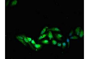 Immunofluorescent analysis of HepG2 cells using ABIN7171009 at dilution of 1:100 and Alexa Fluor 488-congugated AffiniPure Goat Anti-Rabbit IgG(H+L) (SOCS7 抗体  (AA 6-165))