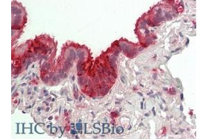 IHC-P analysis of Human Lung Tissue, with HE staining.