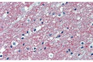 Immunohistochemistry (IHC) image for anti-Programmed Cell Death 1 Ligand 2 (PDCD1LG2) (AA 36-219) antibody (ABIN7443920)