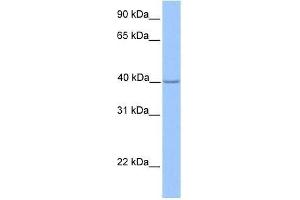 ZNF385D antibody used at 0. (ZNF385D 抗体  (N-Term))