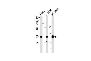 NDUFA9 Antibody (Center) (ABIN1881568 and ABIN2838471) western blot analysis in Hela,Jurkat cell line and mouse heart tissue lysates (35 μg/lane). (NDUFA9 抗体  (AA 99-121))