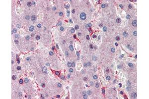 Immunohistochemistry (IHC) image for anti-E3 Ubiquitin-Protein Ligase SIAH1 (SIAH1) (C-Term) antibody (ABIN2780459) (SIAH1 抗体  (C-Term))
