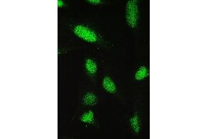 anti-Paired Box 5 (PAX5) (AA 217-282) antibody