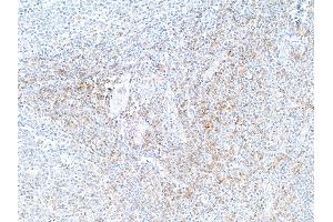 Immunohistochemistry (IHC) image for anti-CD4 (CD4) (AA 26-397) antibody (ABIN7455077) (Recombinant CD4 抗体  (AA 26-397))