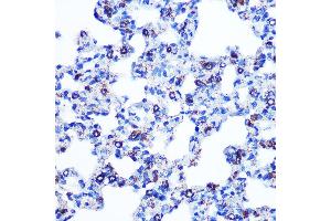 Immunohistochemistry of paraffin-embedded rat lung using Monoamine Oxidase B (MAOB) (MAOB) Rabbit mAb (ABIN7268682) at dilution of 1:100 (40x lens). (Monoamine Oxidase B 抗体)