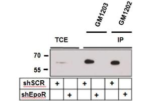 Immunoprecipitation of EpoR with and from A549 lung carcinoma cells expressing control (shSCR) and three EpoR-specific small hairpin RNAs (shEpoR). (EPOR 抗体)