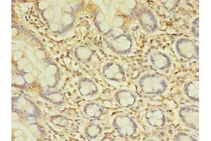 Immunohistochemistry of paraffin-embedded human small intestine tissue using ABIN7172654 at dilution of 1:100 (SPIC 抗体  (AA 1-248))