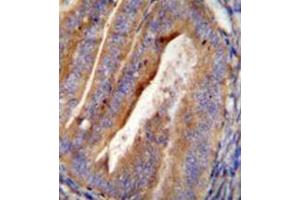 Immunohistochemistry analysis in formalin fixed and paraffin embedded human uterus tissue reacted with OGN Antibody (C-term)  followed by peroxidase conjugation of the secondary antibody and DAB staining. (OGN 抗体  (C-Term))