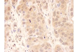 Immunohistochemistry (IHC) image for anti-Ubiquitin Specific Peptidase 8 (USP8) (AA 400-450) antibody (ABIN7454885)