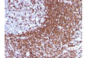 Formalin-fixed, paraffin-embedded human Tonsil stained with CD50 Mouse Monoclonal Antibody (186-2G9). (ICAM-3/CD50 抗体)
