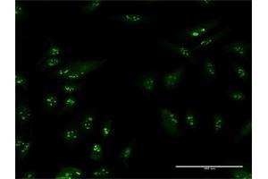 Immunofluorescence of purified MaxPab antibody to TSPYL6 on HeLa cell. (TSPY-Like 6 抗体  (AA 1-410))
