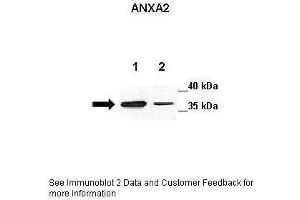 Western Blotting (WB) image for anti-Annexin A2 (ANXA2) (C-Term) antibody (ABIN2774847)