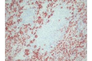 Immunohistochemistry (IHC) image for anti-Macrophages antibody (ABIN781726) (Macrophages 抗体)