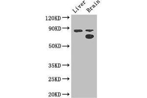 Western Blot Positive WB detected in: Mouse liver tissue, Mouse brain tissue All lanes: SMURF1 antibody at 3. (SMURF1 抗体  (AA 198-374))