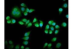 Immunofluorescence staining of Hela cells with ABIN7167118 at 1:133, counter-stained with DAPI. (RIN3 抗体  (AA 245-465))