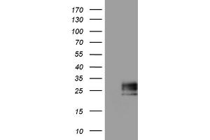 Western Blotting (WB) image for anti-Adiponectin (ADIPOQ) (AA 19-244) antibody (ABIN2715778) (ADIPOQ 抗体  (AA 19-244))