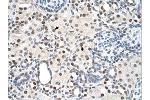 Immunohistochemistry with Tonsil tissue at an antibody concentration of 5µg/ml using anti-PSME3 antibody (ARP46142_P050) (PSME3 抗体  (N-Term))