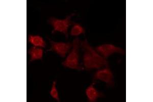 Immunofluorescence (fixed cells) (IF/ICC) image for anti-Cystatin B (Stefin B) (CSTB) (C-Term) antibody (ABIN6261072)