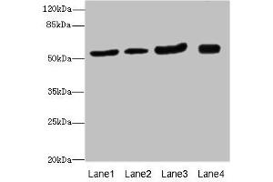 Western blot All lanes: ANTXR2antibody at 1. (ANTXR2 抗体  (AA 340-489))