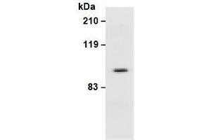 Western Blotting (WB) image for anti-Integrin beta 3 (ITGB3) antibody (ABIN1449278) (Integrin beta 3 抗体)