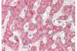 Rabbit Anti-BAAT antibody  Formalin Fixed Paraffin Embedded Tissue: Human Liver Primary antibody Concentration: 1:100 Secondary Antibody: Donkey anti-Rabbit-Cy3 Secondary Antibody Concentration: 1:200 Magnification: 20x Exposure Time: 0. (BAAT 抗体  (N-Term))
