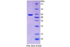 SDS-PAGE analysis of Human PCSK1 Protein. (PCSK1 蛋白)